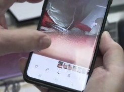 Укус комара в Краснодаре оставил 15-сантиметрового червя в теле девочки из Мариуполя