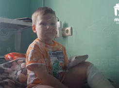 Главный следователь страны взял на личный контроль происшествие с ребенком, пострадавшим в донецком автобусе 