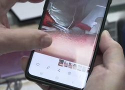 Укус комара в Краснодаре оставил 15-сантиметрового червя в теле девочки из Мариуполя